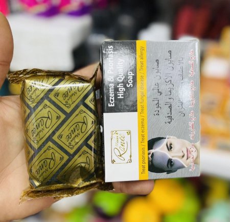 🧼✨ صابونة الكاريزما – للعناية بالبشرة المصابة بالصدفية 🌿🖤